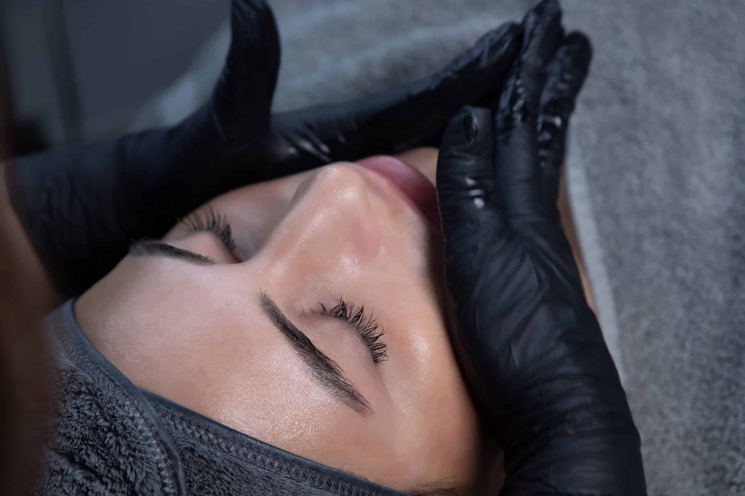 Kosmetikbehandlung Microneedling in Hofheim